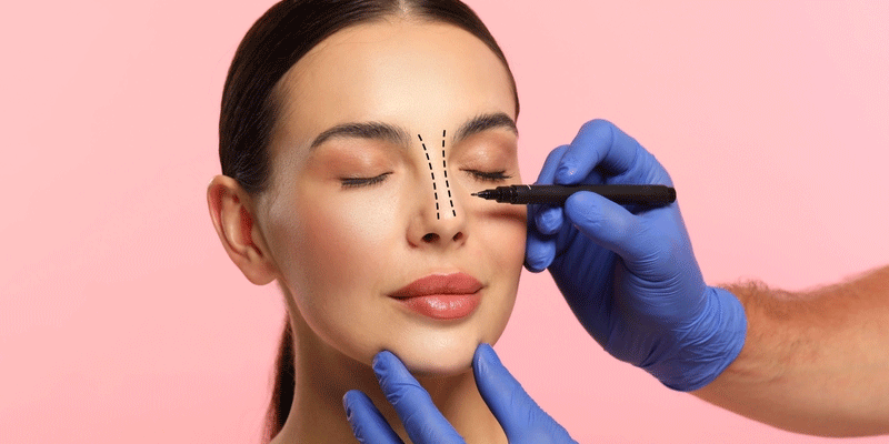 Open vs. Closed Rhinoplasty: Which Approach Is Right for You?